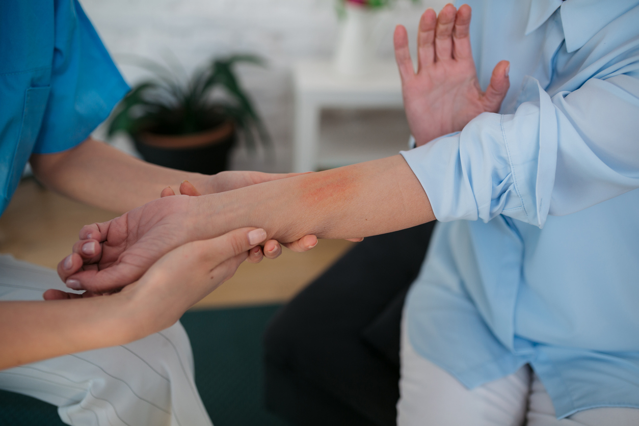 Unrecognizable medical professional holding a hand of a patient with an alarming skin condition, looking at it and carefully accessing the situation